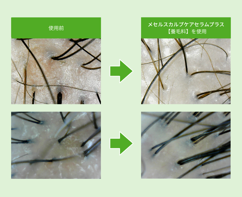 薄毛対策の全体設計
